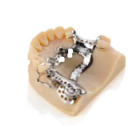 Removeables Dental Models 3D Printer